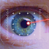 What is LASIK Eye Surgery? Is LASIK painful? Risk, Types & Treatments