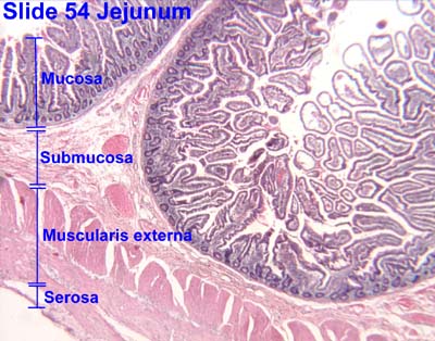 HISTOLOGY PICTURES: Lower Gastrointestinal Tract lymph cell diagram 