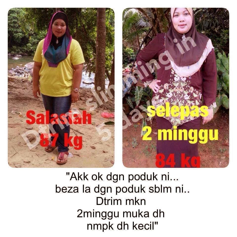 kesan dtrim slimming