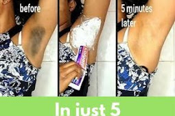 In Just 5 Minutes Your Underarms Will Become Super White And Fairer