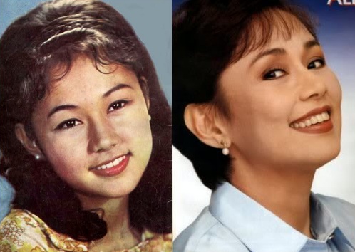 Philippine Actresses That Have Undergone Surgery | Gossip Ghirl