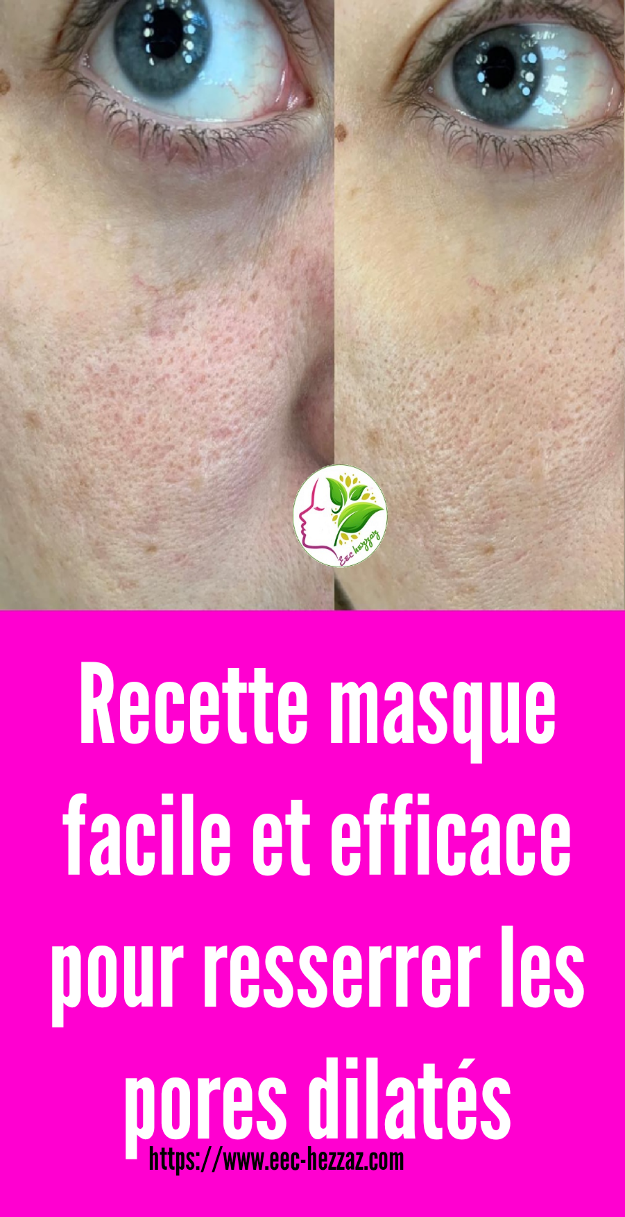 Recette masque facile et efficace pour resserrer les pores dilatés