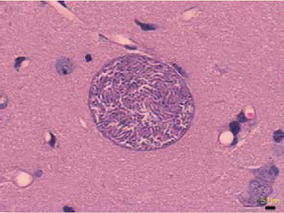 alt="toxoplasmosis vista al microscopio"