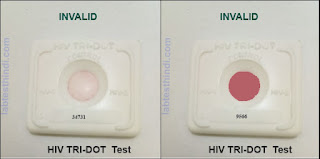 HIV Invalid test