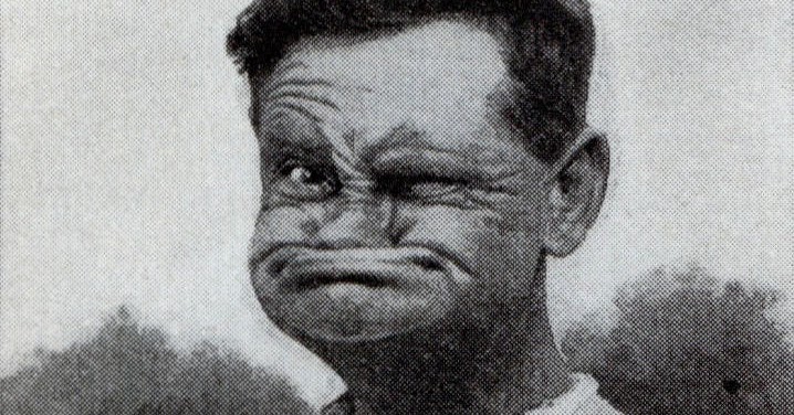 Englishman Swallows Nose to Pull World’s Ugliest Face, 1934 ~ vintage