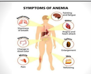 Symptom-of-Anemia