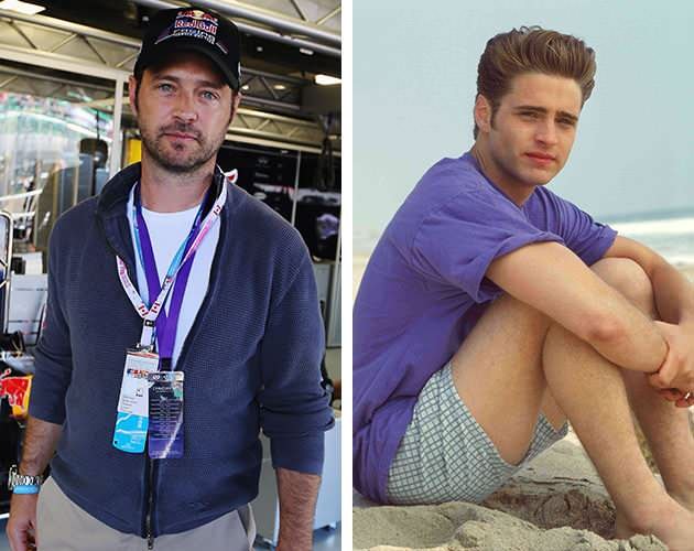 Jason Priestley Plastic Surgery