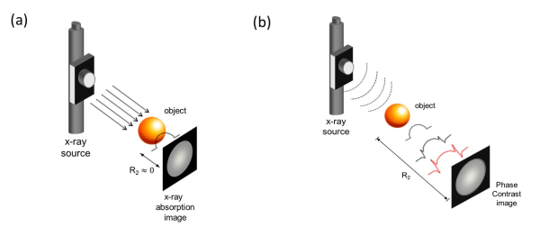 Phase-contrast X-ray imaging techniques 相位對比X光成像技術
