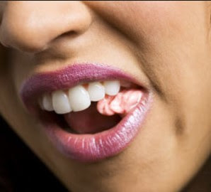 Gerakan senam wajah chew gum
