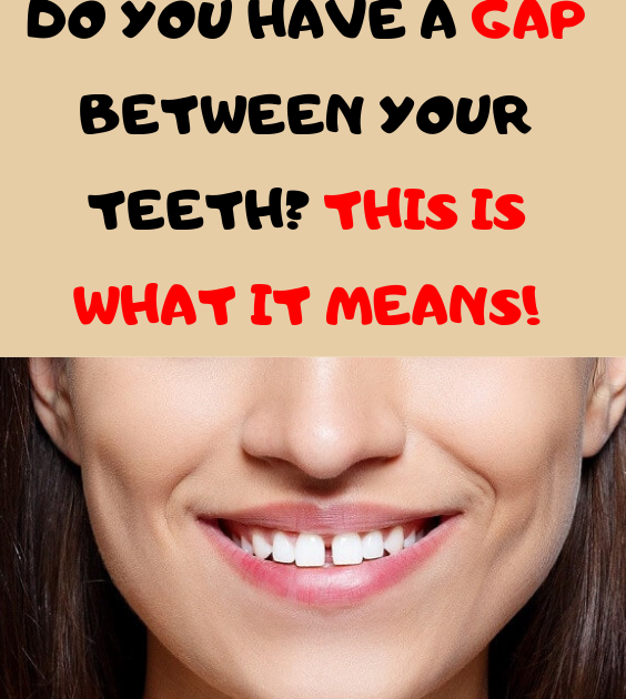 gap teeth