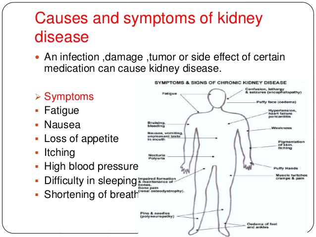 kidney infection symptoms related keywords suggestions for kidney infection symptoms kidney infection symptoms related keywords suggestions for kidney infection symptoms