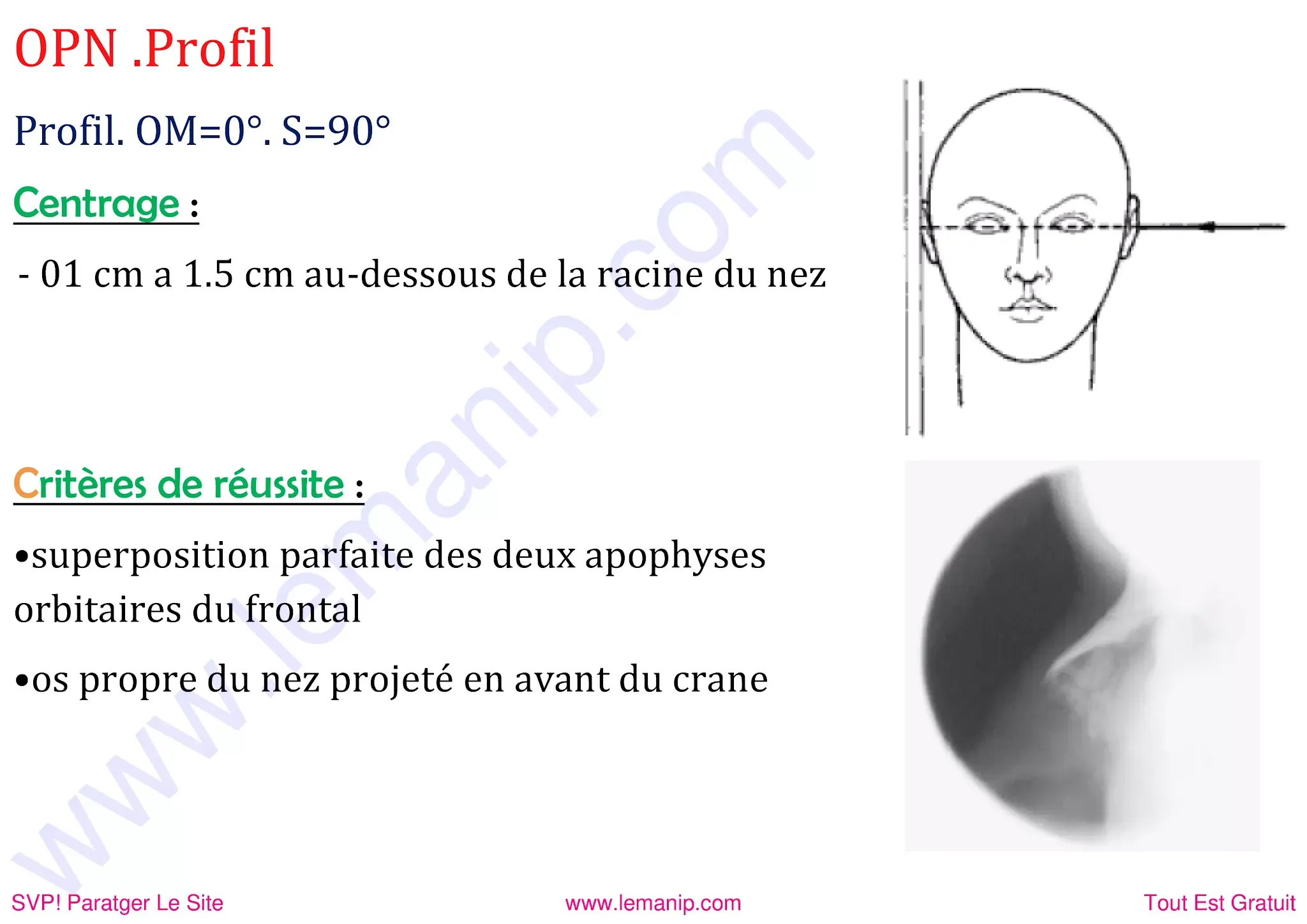 OPN profil