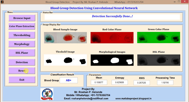 Matlab code for Blood Group Detection using Neural Network ...