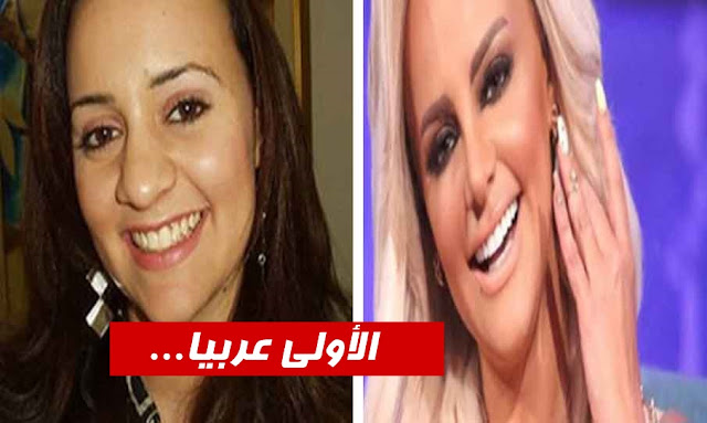 تونس الأولى في العالم العربي في العمليات التجميلية - بالفيديو