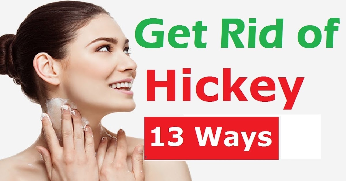 How To Get Rid Of Hickeys Fast Aka Love Bite Or Kiss Mark