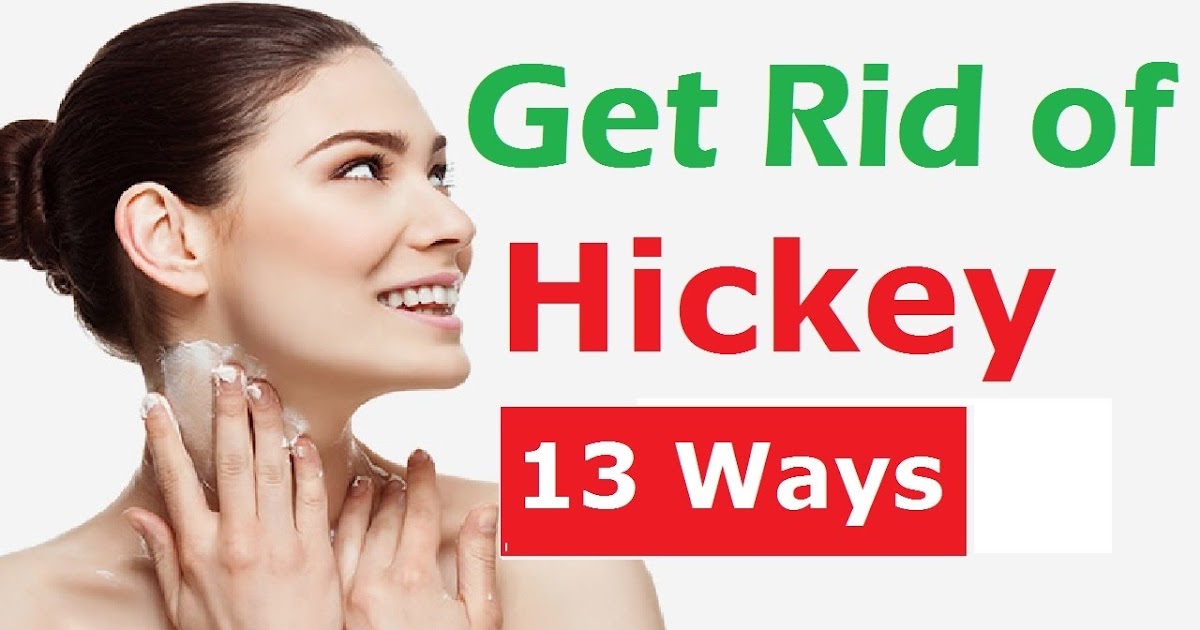 How to Get Rid of Hickeys Fast? AKA love bite or kiss mark