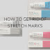 How To Get Rid of Stretch Marks