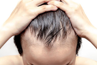 علاج فعال و مضمون لمحاربة تساقط الشعر و إنبات الفراغات