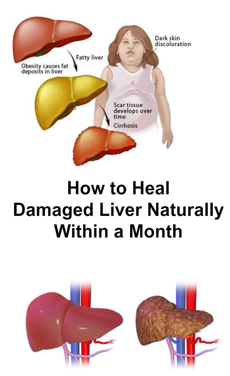 How to Heal Damaged Liver Naturally Within a Month Healthy Clear