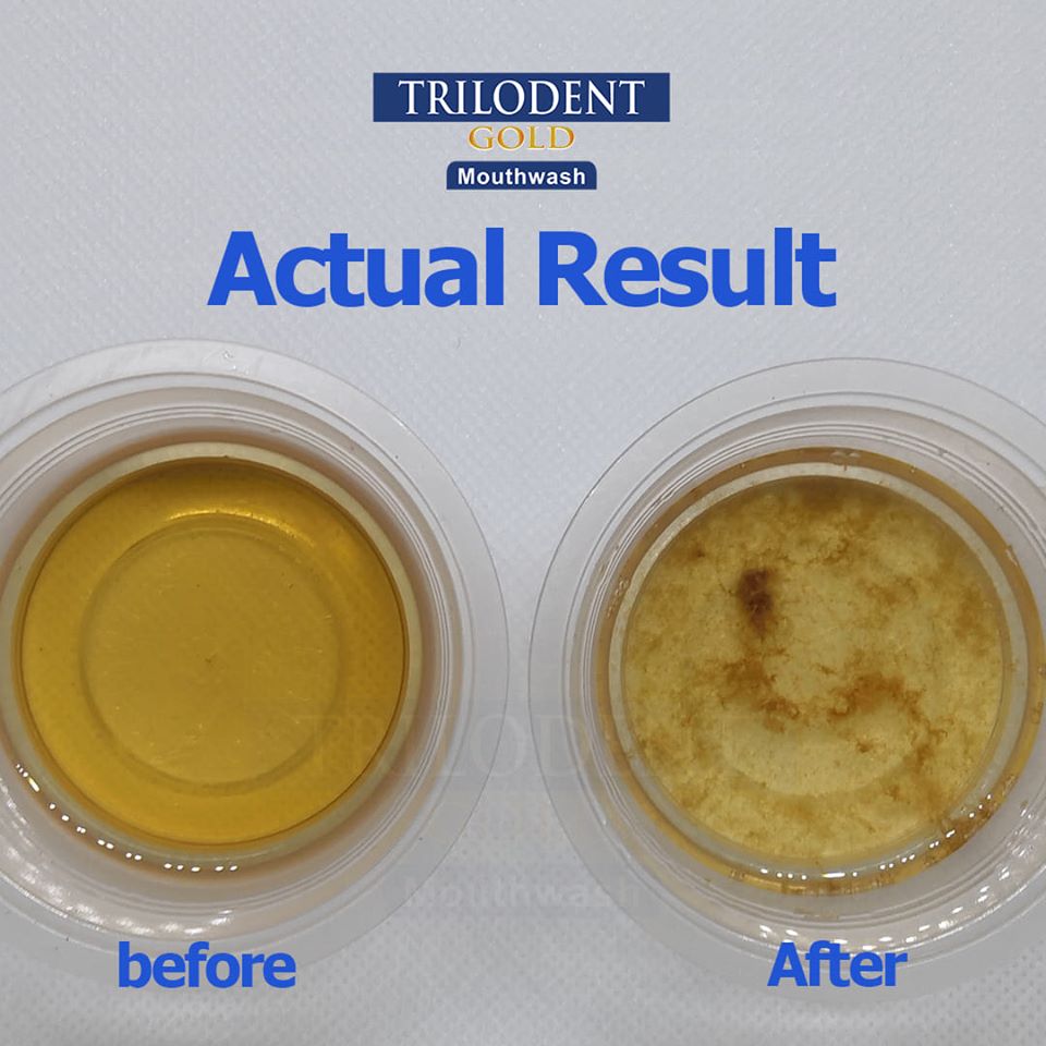 Effective ways to achieve that fresh breath & sparkling white teeth