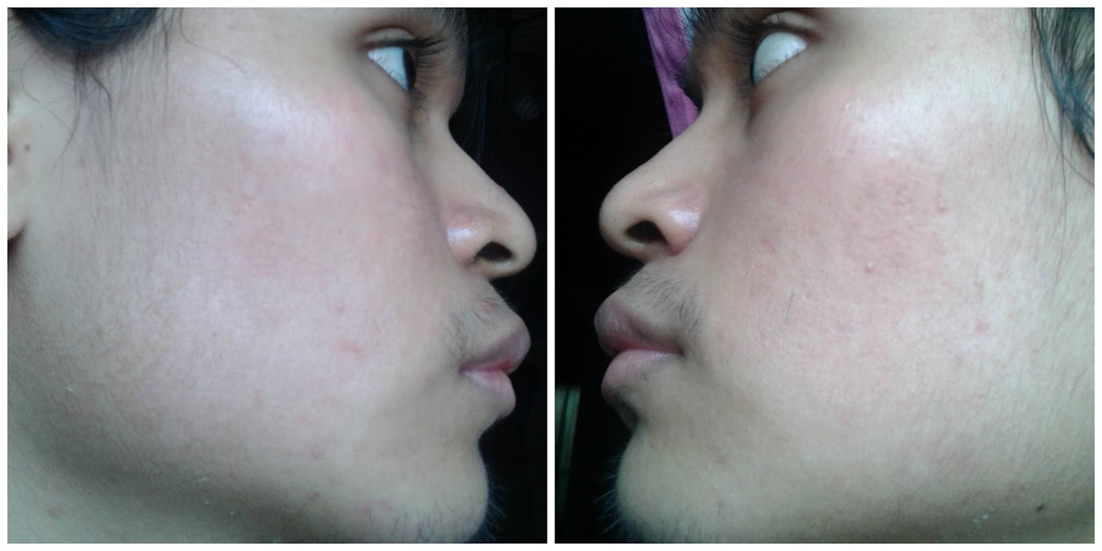 Makeup Artist's Choice Before/After Pics and Testimonials