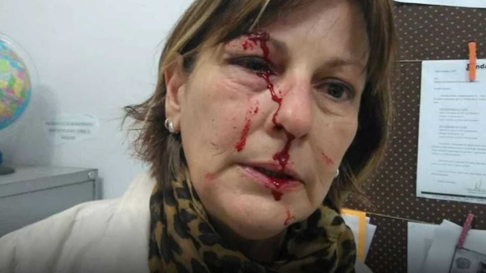 Professora agredida em SC faz carta à ministra Damares pedindo respeito