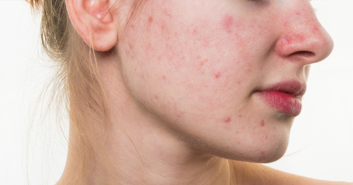 How to treat common skin problems?