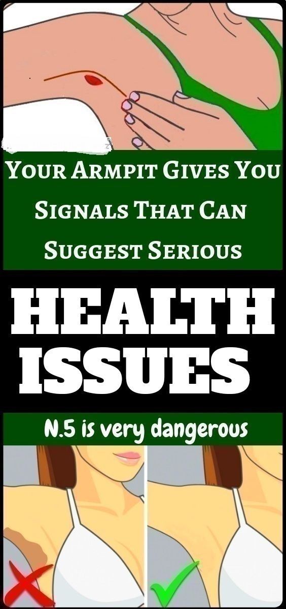 6 Armpit Signals That Can Indicate Health Issues Healthy Nice 200