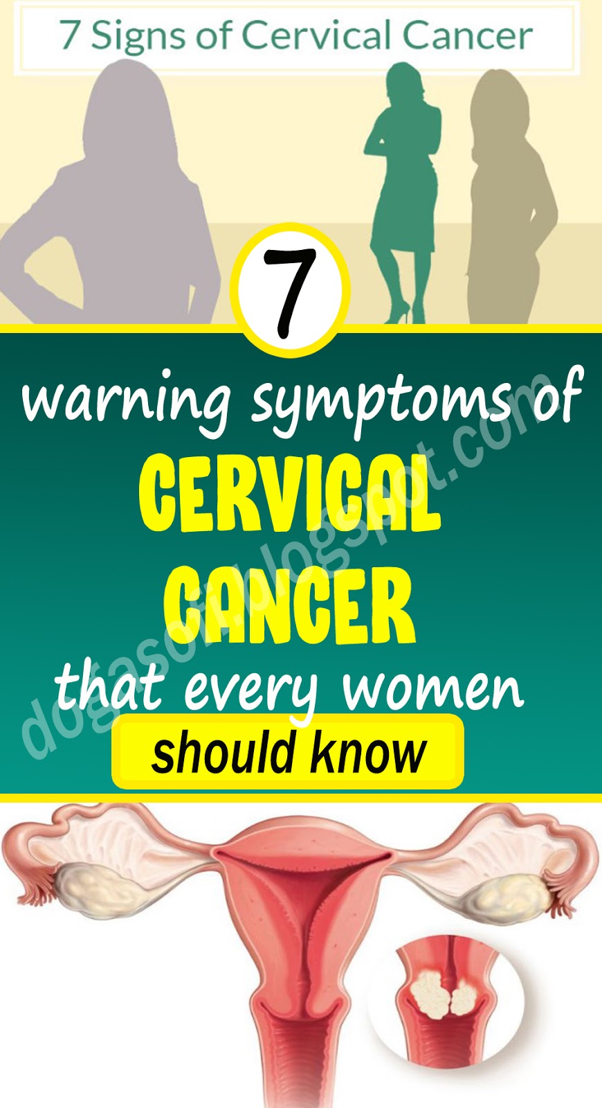 Cervical Cancer Symptoms Warning Signs