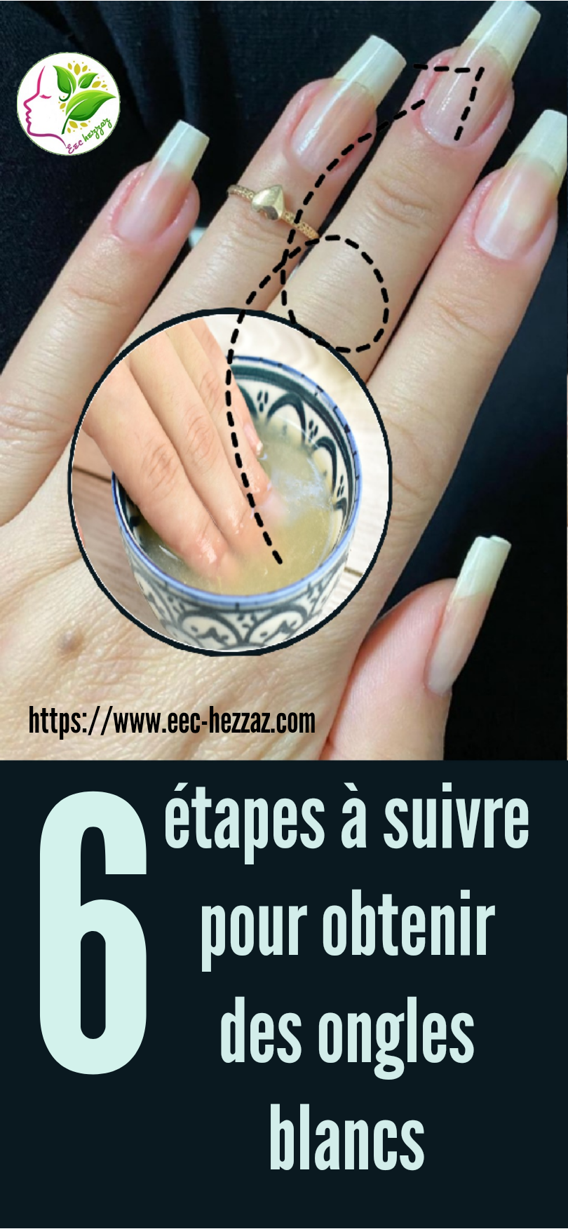 6 étapes à suivre pour obtenir des ongles blancs