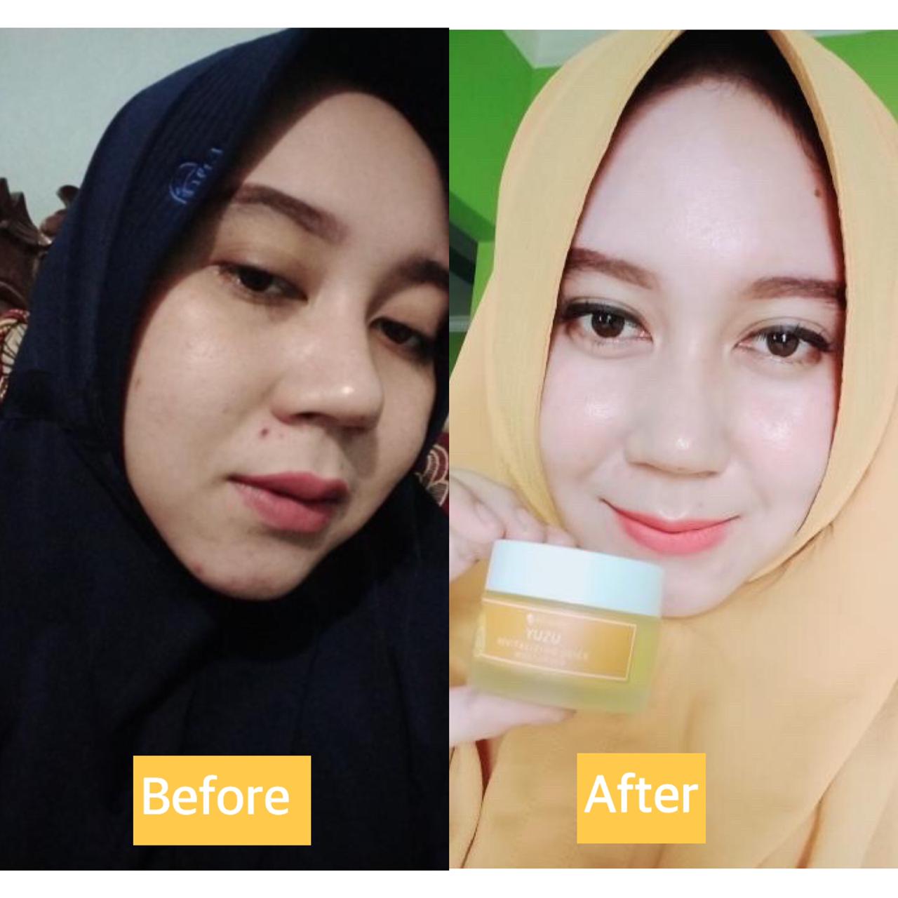 testimoni ms glow skin care