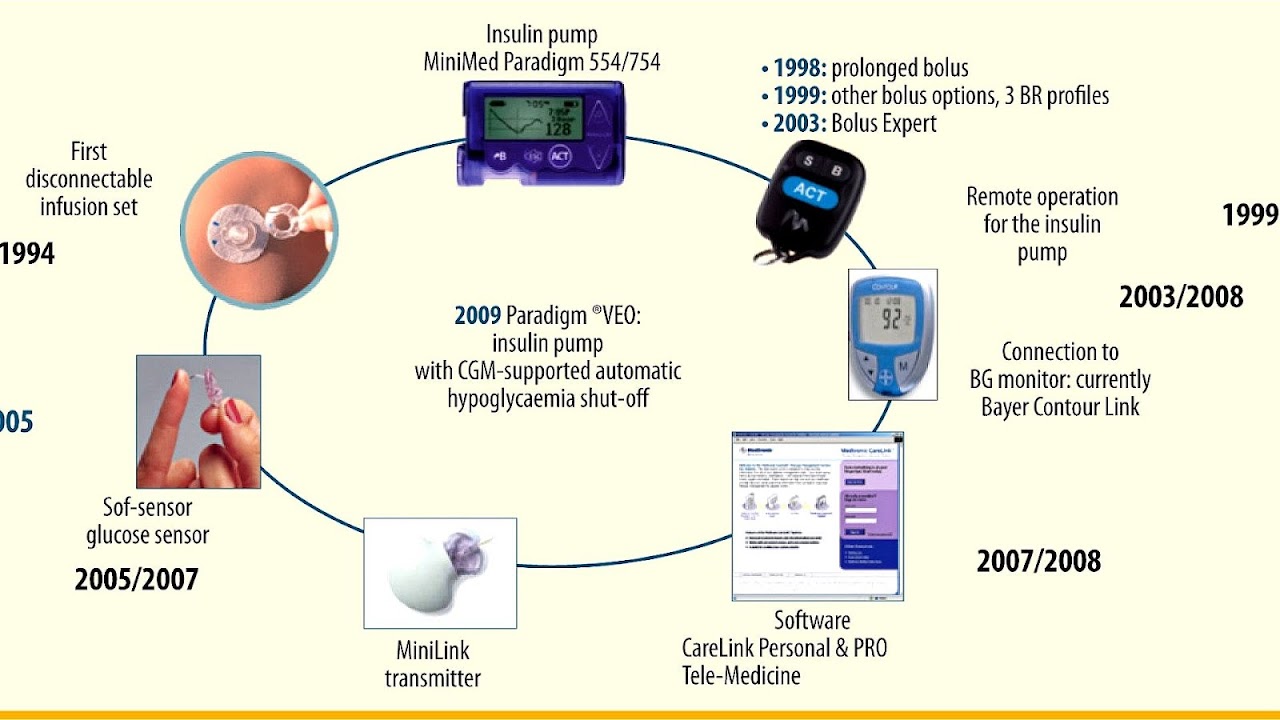 Insulin Pump Diagram - Insulin Choices