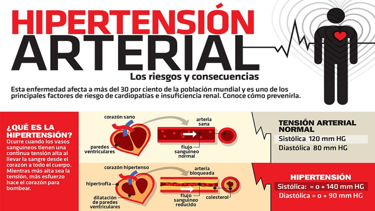Proyecto De Intervencion Educativa Sobre Hipertension Arterial