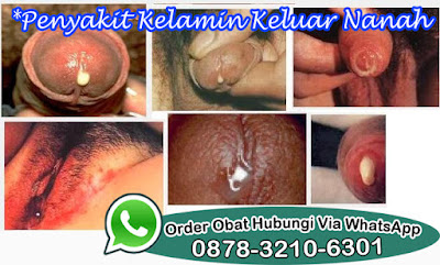 Cara Mengatasi Kencing Nanah Tanpa Obat Dan Ramuan