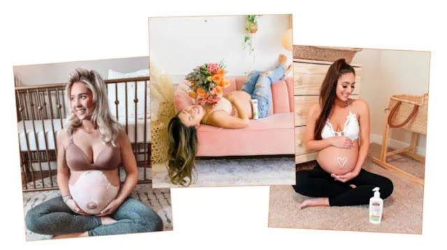 10 Ways to Get Rid of Stretch marks After Childbirth 10 Ways to Get Rid of Stretch marks After Childbirth
