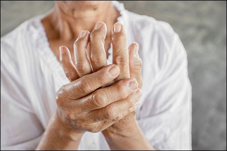 How can Rheumatoid Arthritis be treated with Herbal Medicine? - Dr