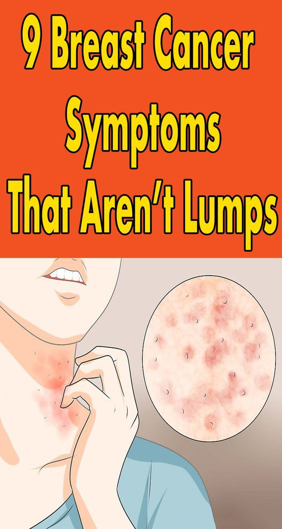 9 Breast Cancer Symptoms That Arent Lumps Sweet Oh Joy