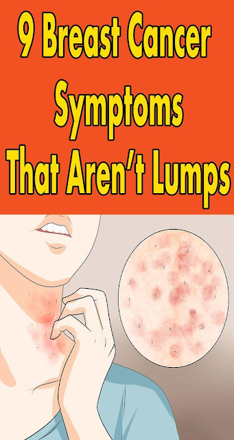 9 Breast Cancer Symptoms That Aren’t Lumps