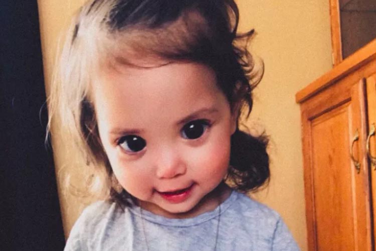 Criança com síndrome de 'olhos grandes' comove internautas