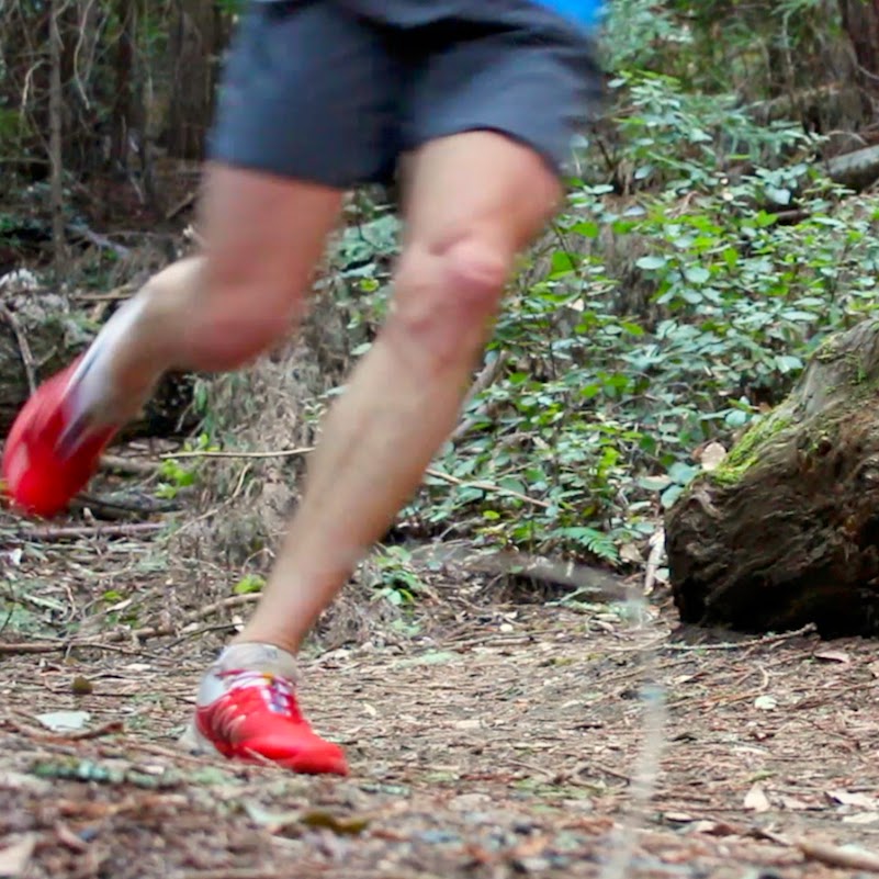 My Running Doc Can I Run with Plantar Fasciitis?