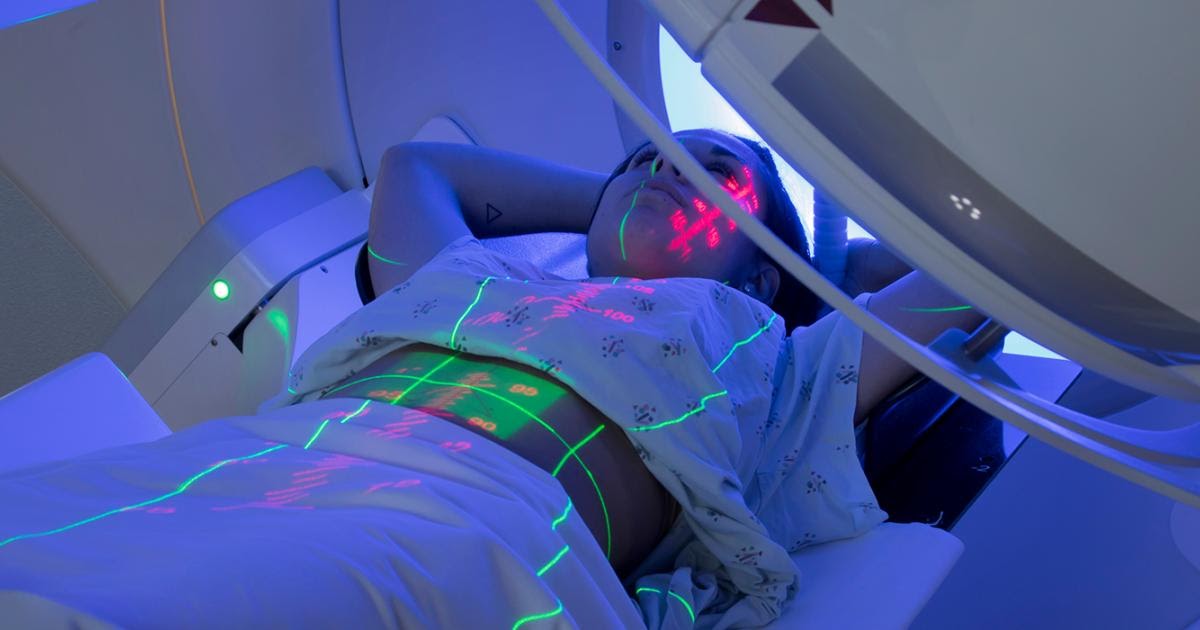 лучевая терапия лимфоузлов. лучевая терапия при онкологии. лучевая терапия лимфоузлов. тиратрон лучевая терапия. лучевая терапия при онкологии предстательной железы.