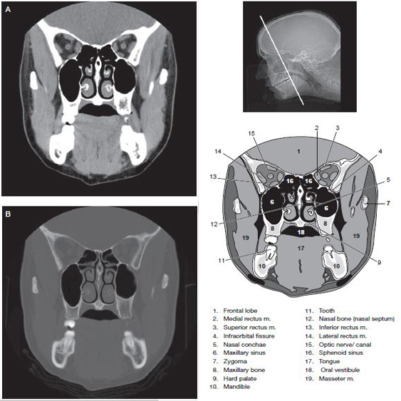 Sinus CT Scan RadTechOnDuty