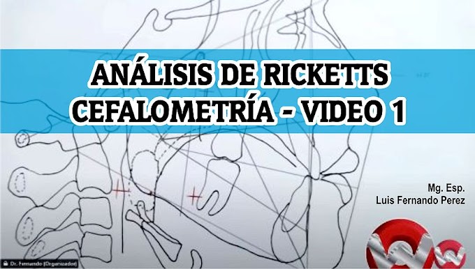 CEFALOMETRÍA: Análisis de Ricketts - Video 1