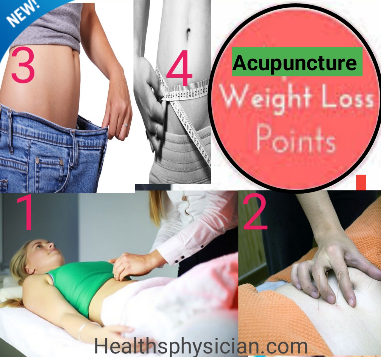 acupuncture points for weight loss with chart (acupuncture) Health