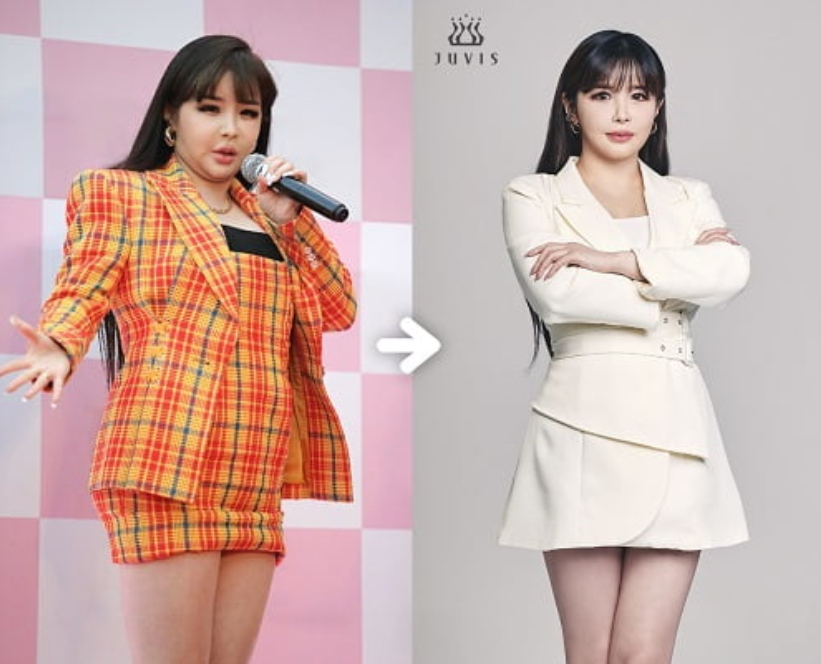 Park Bom who suffered from ADD, 11kg weight loss...70kg→59kg (photo)Source:...