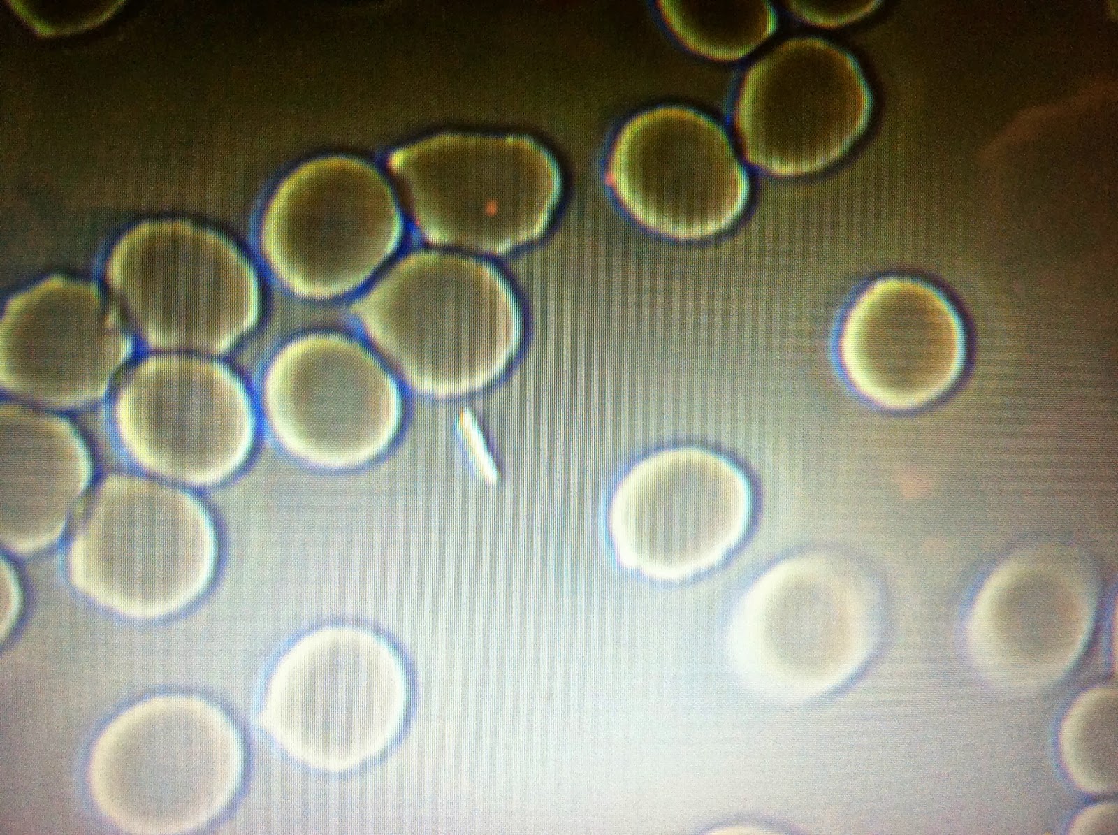 Diseases Under Microscope