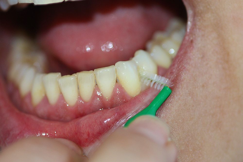 HIGIENE BUCAL Limpieza Interproximal. Interprox OdontoFarma