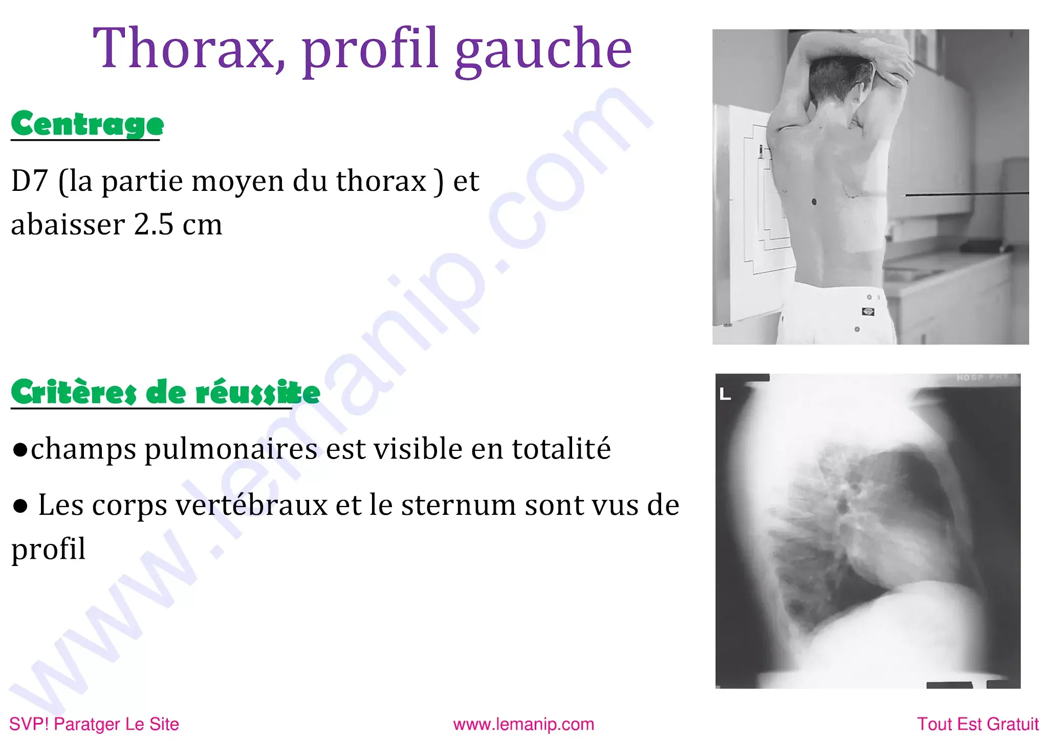 Thorax de profil