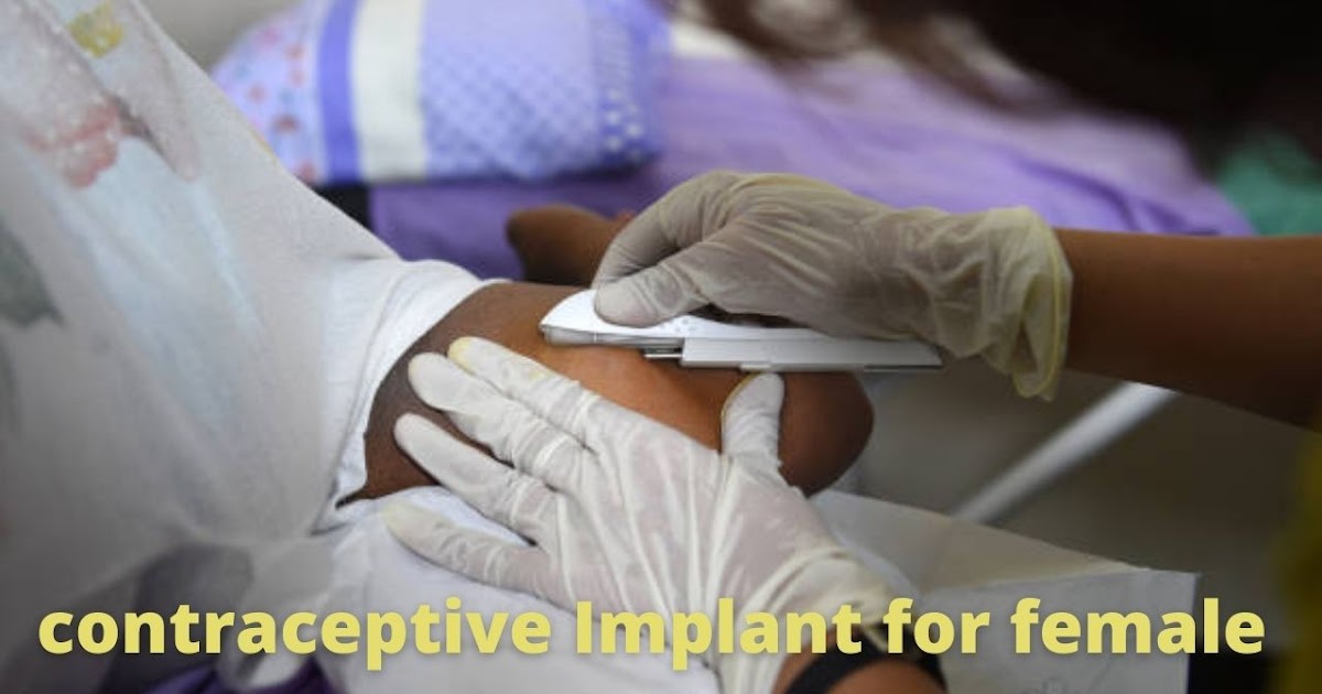 Birth control Arm Implant Uses & Benefits for Woman DGS Health