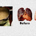 This recipe will easily clear your lungs in 3 days, even if you smoke more than 5 years